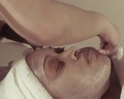 Chemical Peels, Teaneck, NJ