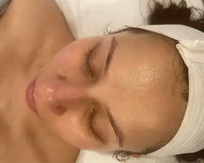 Teen Facials, Teaneck, NJ